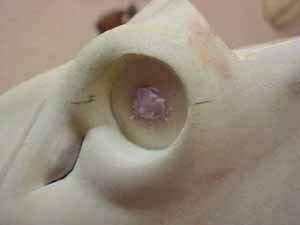 prepared_eye_socket