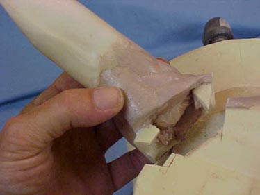 removing_earliner